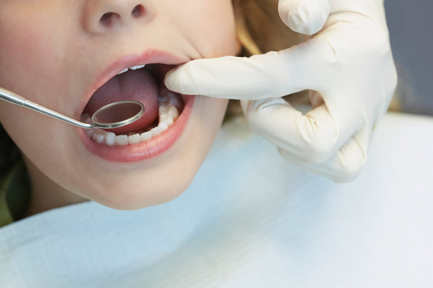 Endodontie chez l'enfant à Saint Hubert.